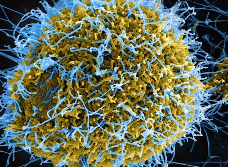 Ebola: Nigeria Faces High Risk of Imported cases,NCDC Warns